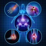 CLH Physio & Sports Therapy